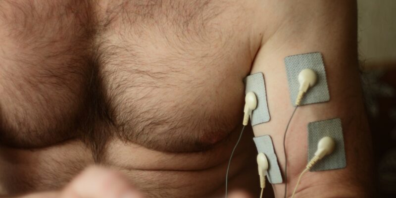 electrostimulation