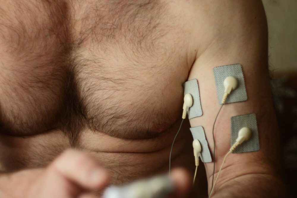 electrostimulation